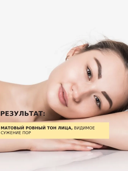 MIXIT Сыворотка для лица себорегулирующая, ниацинамид и цинком, для проблемной кожи, 30 мл