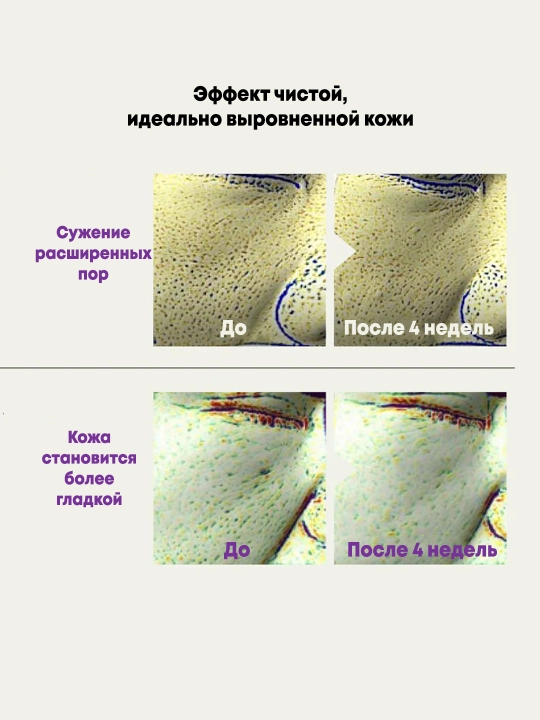 Yangilovchi retinol serumi Anua Retinol 0.3% + Niacin Renewing Serum