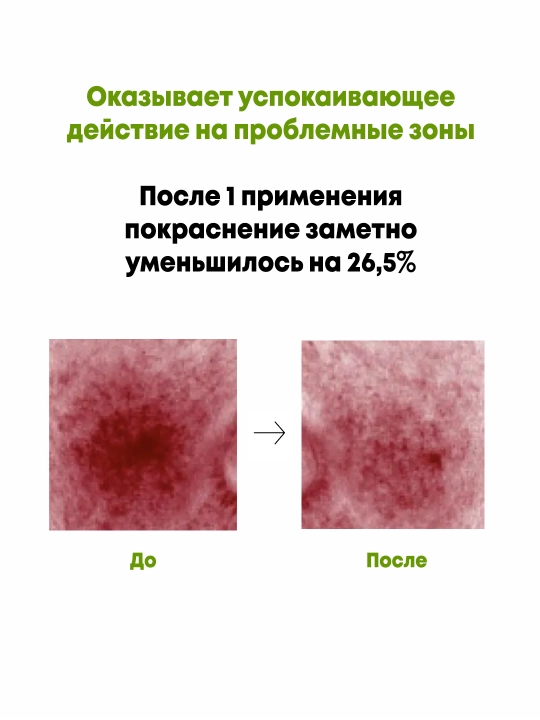 Успокаивающий крем с азелаиновой кислотой Anua Azelaic Acid CICA Skin Soothing Moisturizer