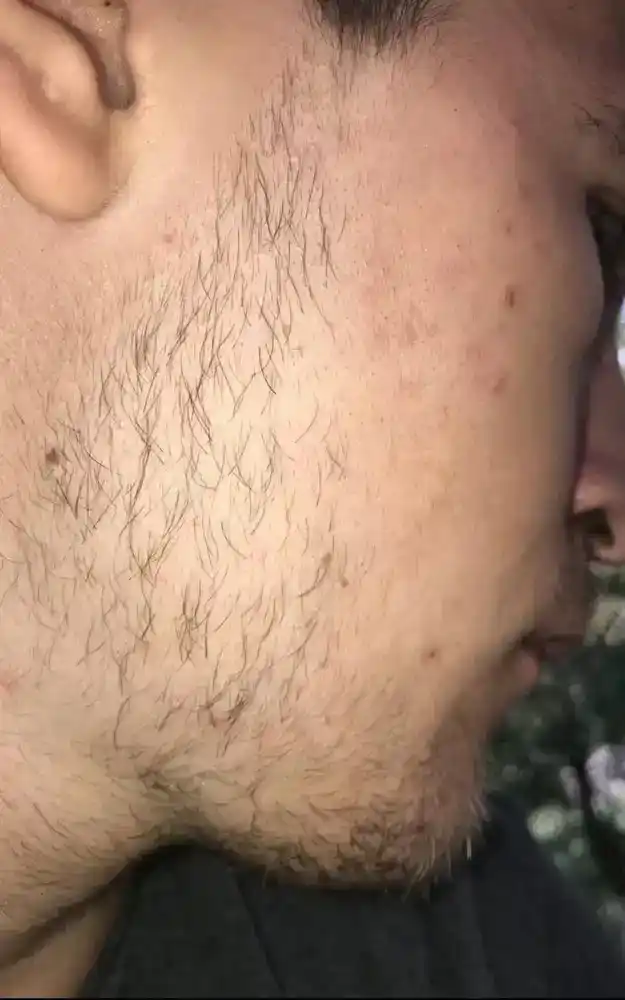 Soqol va soch o‘sishi uchun Beard Growth moyi, minoksidil ta’siri