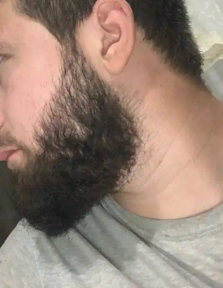 Soqol va soch o‘sishi uchun Beard Growth moyi, minoksidil ta’siri