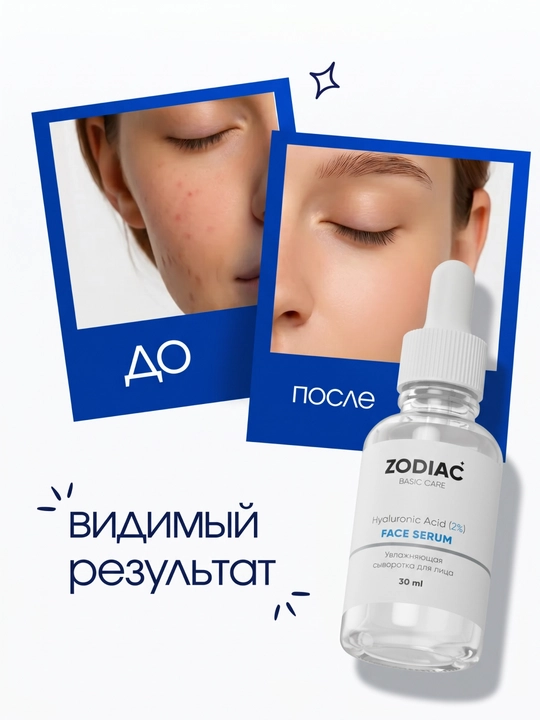 ZODIAC yuz uchun zardob, serum, gialuron kislota, namlaydi, niatsinamid, akne uchun, 30 ml