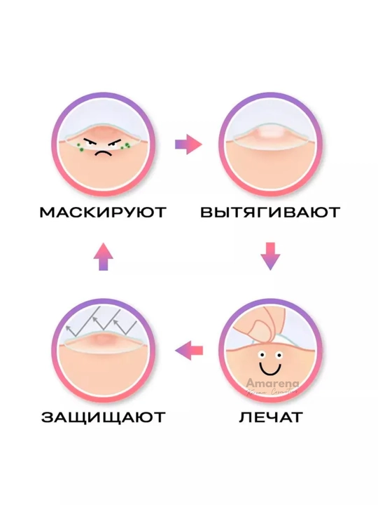 Патчи от прыщей, угрей и акне, гидроколлоидные пластырь наклейки, невидимые, 3 размера