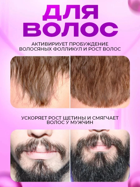 Дермо-ролик для лица, 1 мм, 540 игл