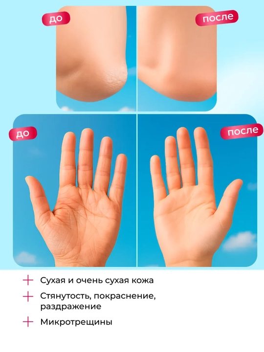 SOS-бальзам для рук Витэкс Pharmacos Panthenol UREA 10%, для очень сухой кожи, 75 мл