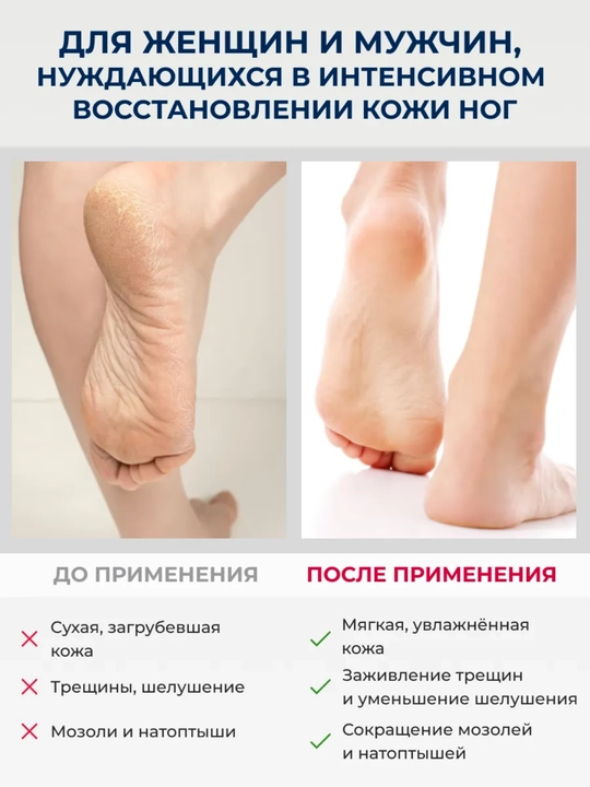 Крем для ног от мозолей, натоптышей, сухости и трещин  PANTHENOL UREA антибактриальный