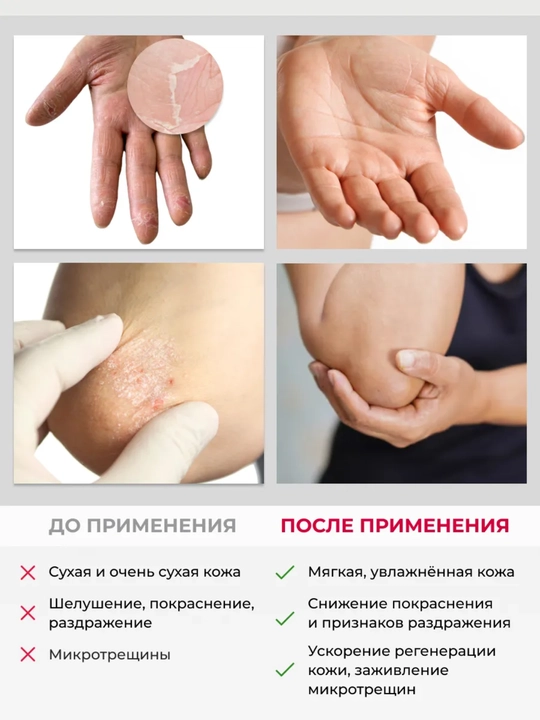 Крем-бальзам для очень сухой кожи рук и локтей Pharmacos PANTHENOL UREA 10%, 75 мл, Витэкс