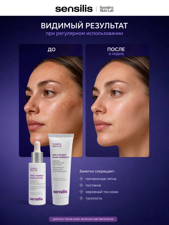 Sensilis D-Pigment Correction pigmentatsiyaga qarshi yorituvchi to‘plam, 2×30 ml