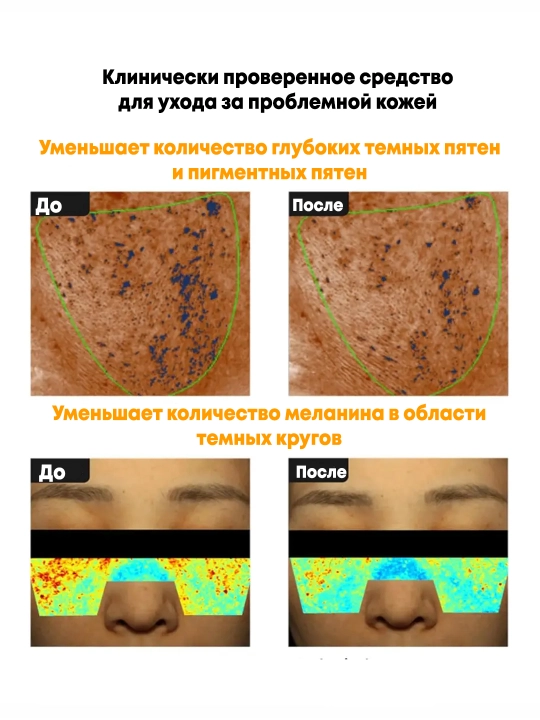 Pigmentatsiya va poralar uchun yorituvchi krem Celimax Pore+Dark Spot Brightening Cream