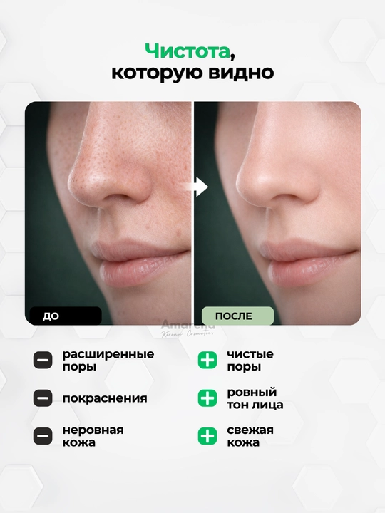 Очищающие полоски для носа от черных точек и акне Etude Organix, для женщин и мужчин