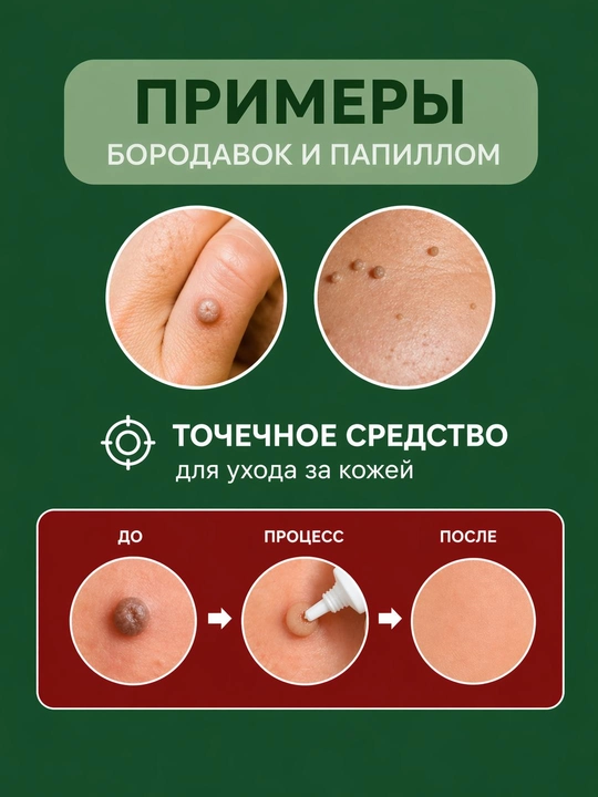 Косметический набор 2 в1: гель и защитный крем "Антипапиллом" от папиллом и бородавок