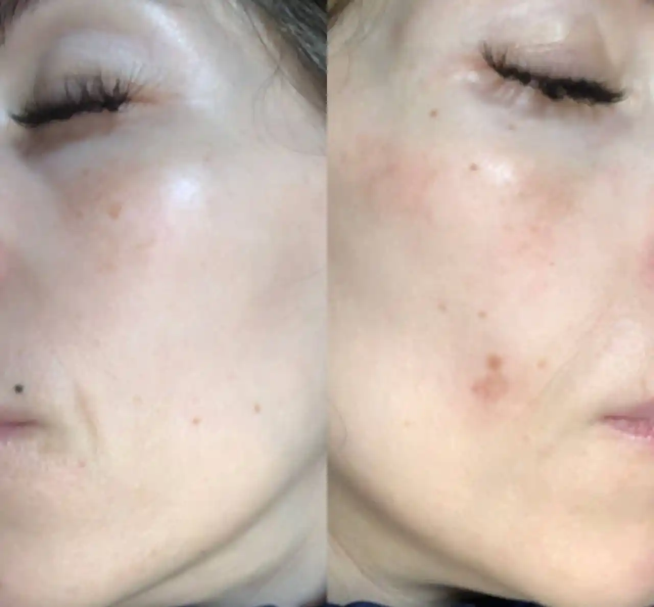 Dr.Althea PDRN 10000 Melaclear Cream-осветляющий крем для борьбы, с пигментацией постакне