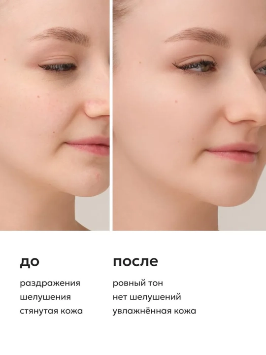 Likato Гель для умывания от прыщей, акне, постакне с AHA кислотами, 250мл