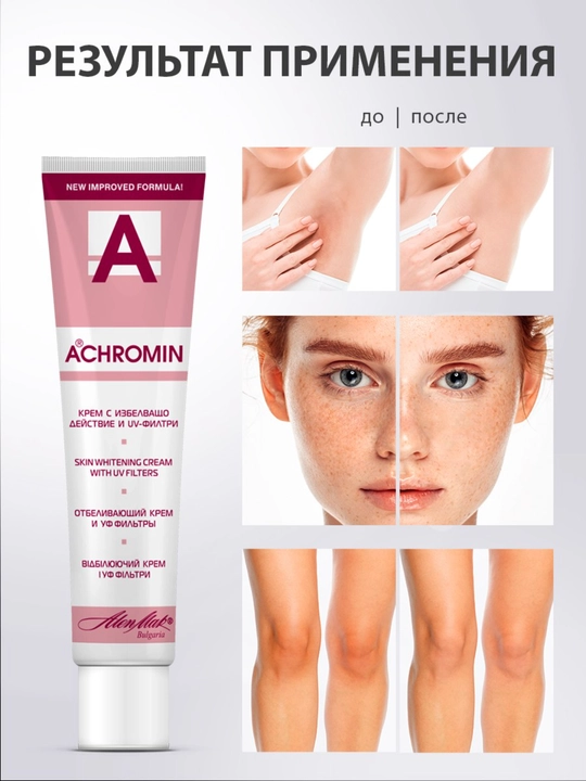 Yuz va tana uchun oqartiruvchi Achromin kremi, intim sohalar uchun ham mos, 45 ml