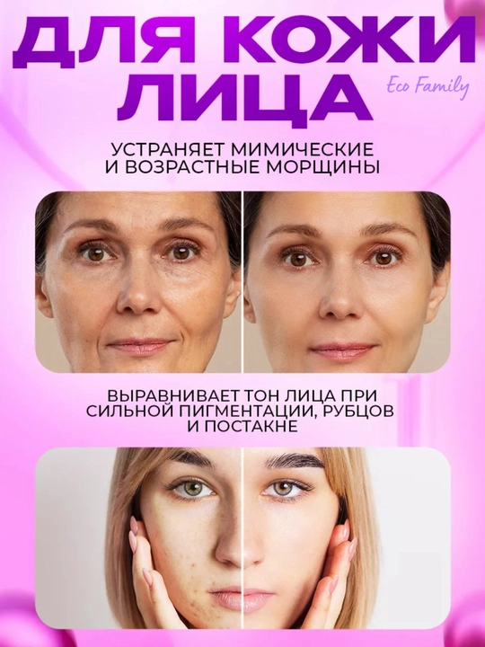 Мезороллер для лица и тела 540 игл, дермароллер массажер ролик для лица, тела и волос 