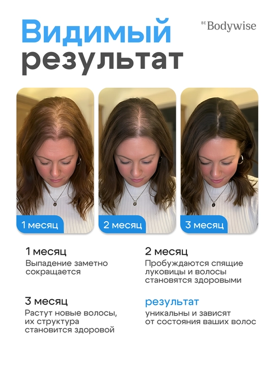 Сыворотка для роста волос Hair Growth Serum Rooll-on Bodywise, 25 мл, от выпадения