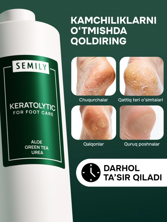 Keratolitik, quruq tovon yoriqlariga qarshi aloyli suyuq pichoq,SEMILY oyoq pilingi, 400 ml