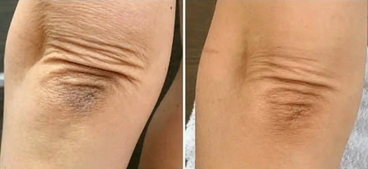Dr.Althea PDRN 10000 Melaclear Cream-осветляющий крем для борьбы, с пигментацией постакне