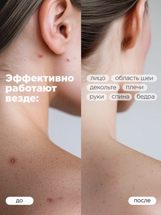 MIXIT NONI&MATCHA Тонеры для лица: увлажняющий, восстанавливающий, с нони и матчей, 150 мл