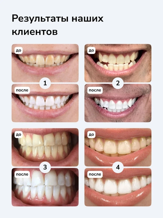 Отбеливающие полоски-патчи для зубов Hismile, полоски для отбеливания