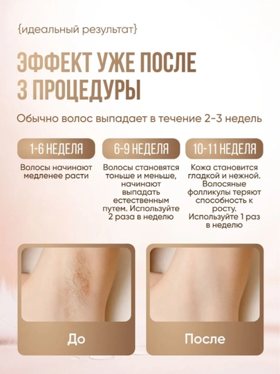 Фотоэпилятор лазерный Professional, для лица и тела, ледяное охлаждение, IPL 3в1