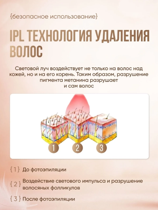 Фотоэпилятор лазерный Professional, для лица и тела, ледяное охлаждение, IPL 3в1