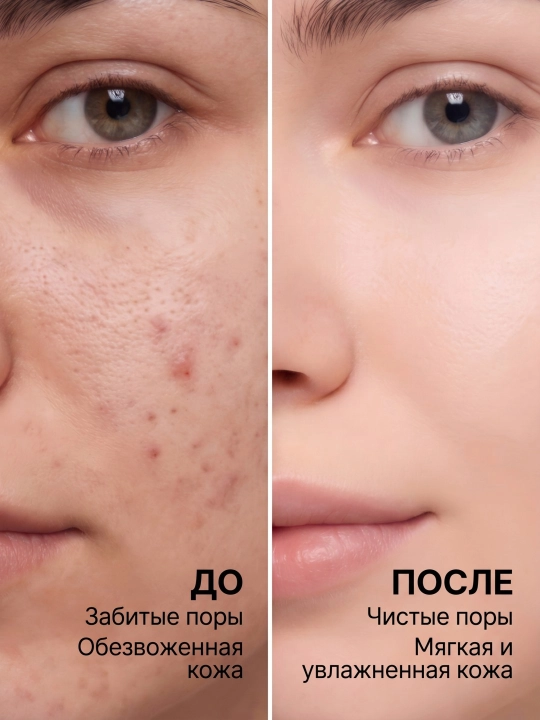 Fengma neyron seramid muloyim tozalovchi ko'pik mus, 250 ml
