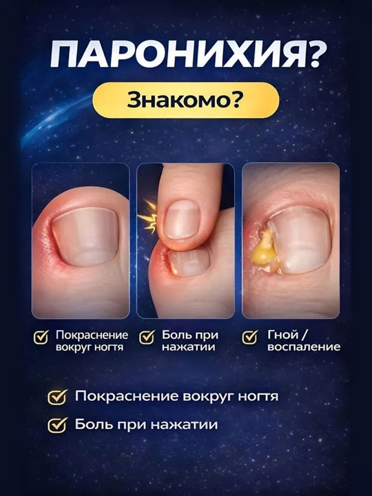 Масло, используемое для ухода за ногтями на ногах, для удаления вросших ногтей и паронихия