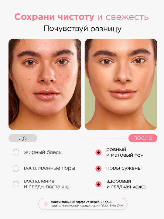 Тоник для лица MIXIT матирующий с ниацинамидом, 150 мл