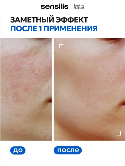 Лосьон для лица от пигментных пятен, осветляющий тоник Sensilis Azelaic Peel 100 мл