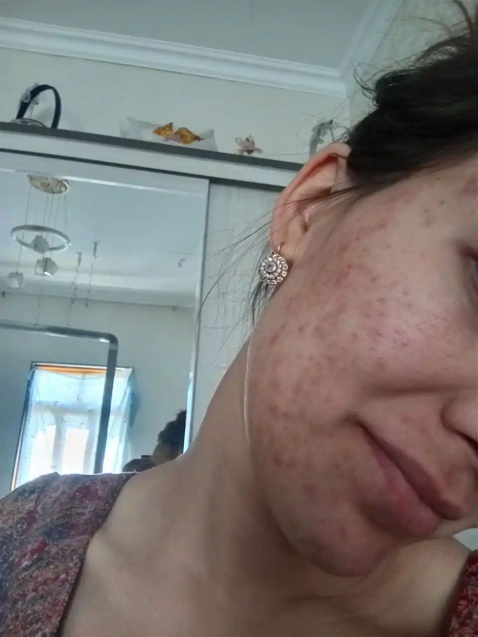 Сыворотка для лица The Ordinary Niacinamide 10% + Zinc 1%, 30 мл