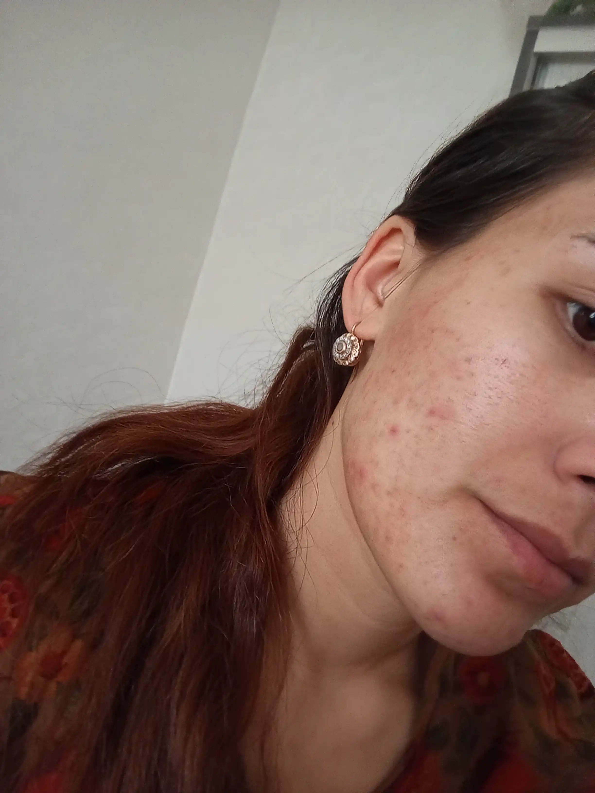 Сыворотка для лица The Ordinary Niacinamide 10% + Zinc 1%, 30 мл