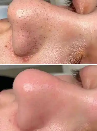 Крем для лица отбеливающий Celimax Pore+Dark Spot Brightening, витамин С, ниацинамид