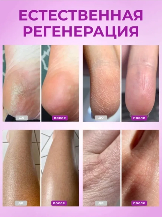 Oyoq va qo‘llar uchun AYA mumli krem, yoriqlarga qarshi, mochevina  tovonlar yumshatuvchi