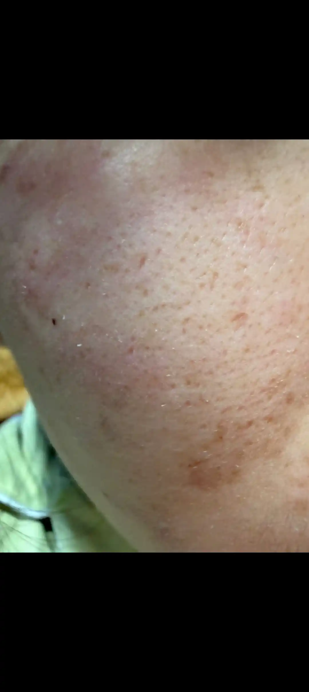Retinolni mustahkamlovchi zardob va retinolni mustahkamlovchi kuchaytiruvchi krem, Celimax