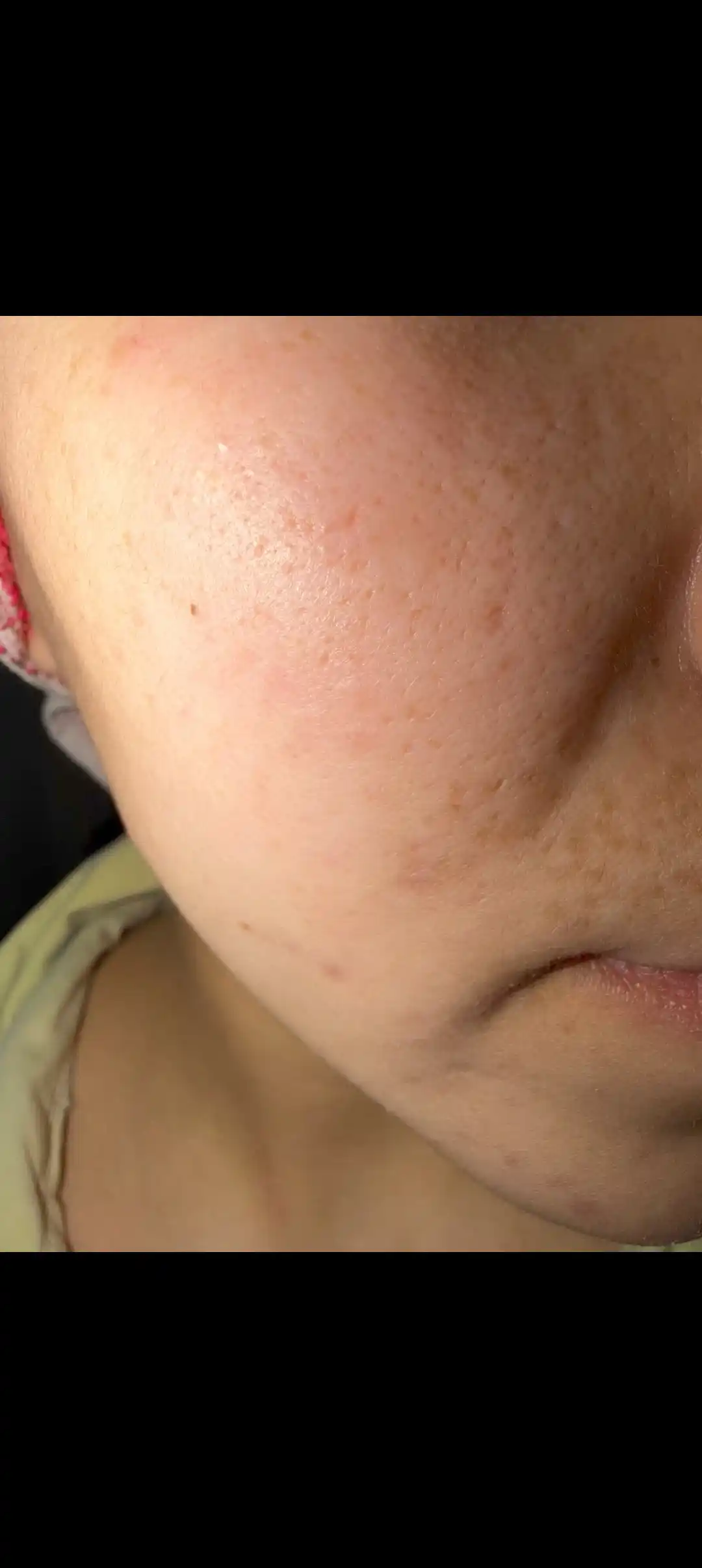 Retinolni mustahkamlovchi zardob va retinolni mustahkamlovchi kuchaytiruvchi krem, Celimax