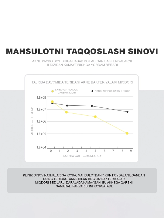 SKINEVER Akne va husnbuzarlarga qarshi tungi yuz niqobi, salitsil kislotasi bilan, 55 ml