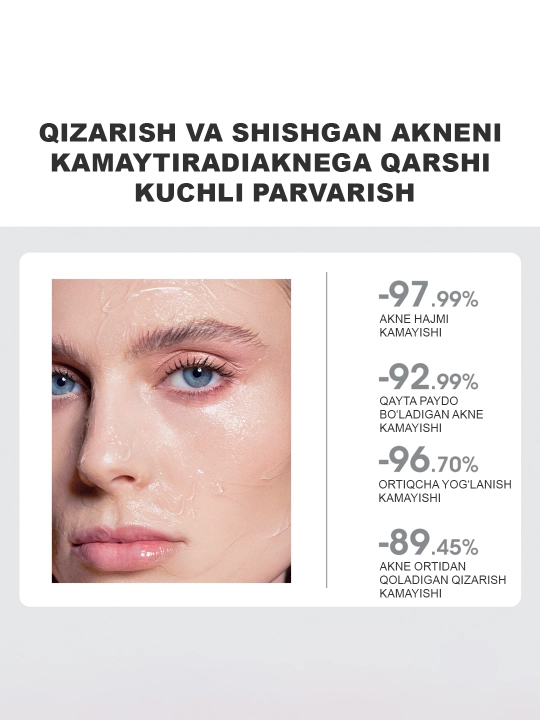 SKINEVER Akne va husnbuzarlarga qarshi tungi yuz niqobi, salitsil kislotasi bilan, 55 ml