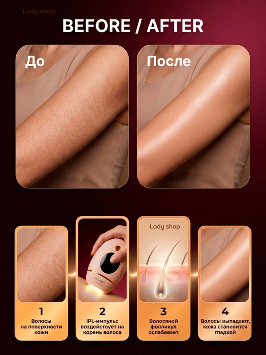 Фотоэпилятор MAC Styler IPL, технология охлаждения ICE, 999999 вспышек, 5 режимов