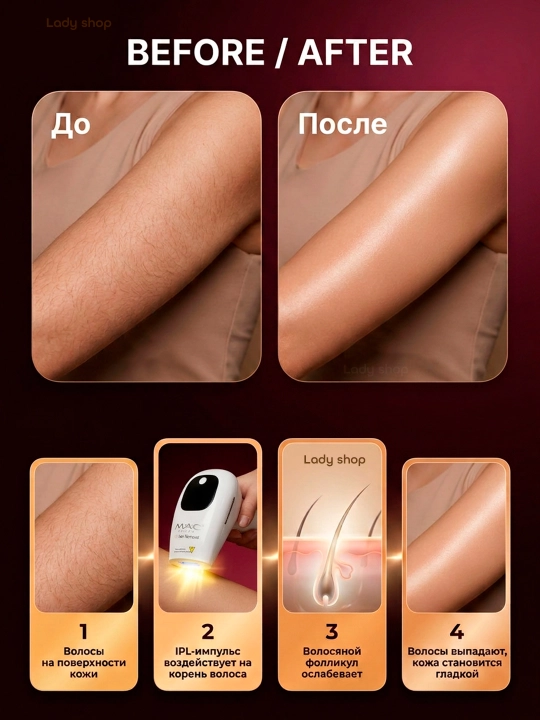 Фотоэпилятор MAC Styler IPL, технология охлаждения ICE, 999999 вспышек, 5 режимов