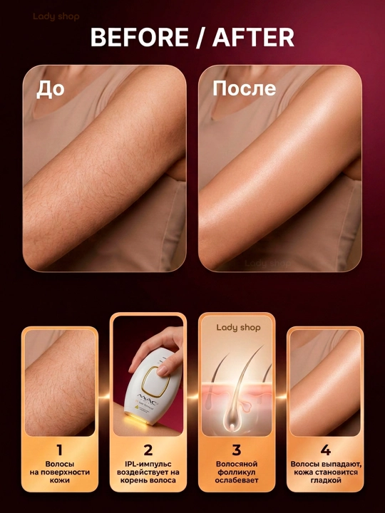 Фотоэпилятор MAC Styler IPL, технология охлаждения ICE, 999999 вспышек, 5 режимов