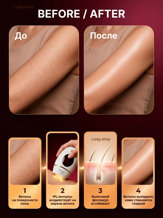 Фотоэпилятор MAC Styler IPL, технология охлаждения ICE, 999999 вспышек, 5 режимов