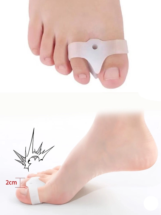 Oyoq barmoqlari uchun silikon ajratgich, oyoqning valgus deformatsiyasida - 