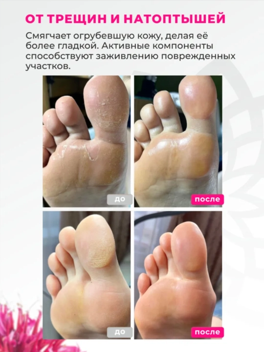 Крем воск от трещин AYA для ног, крем для ног, для пяток, крем для пяток с монардой, 100 г
