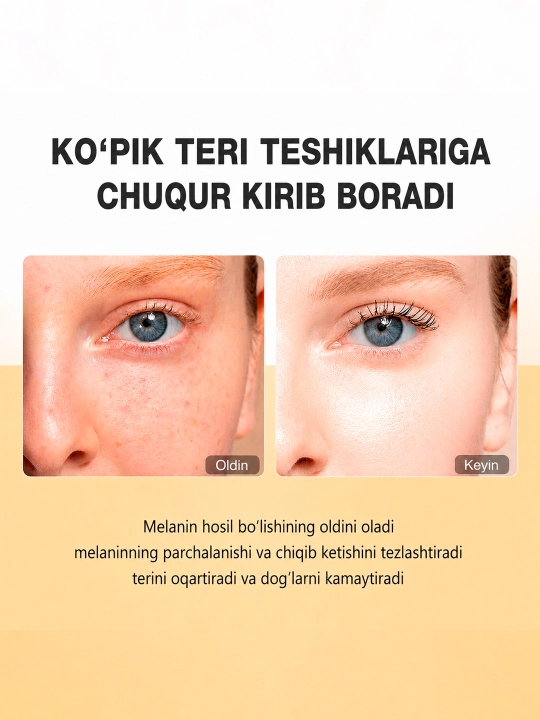 Гель для умывания SKINEVER Salicylic Acid против акне с салициловой кислотой