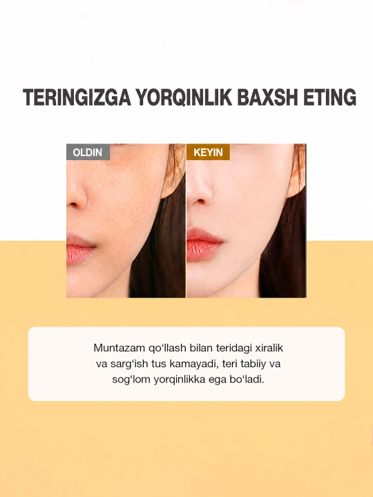 Oqartiruvchi yuz toneri SKINEVER Vitamin C Brightening Toner, niatsinamid bilan