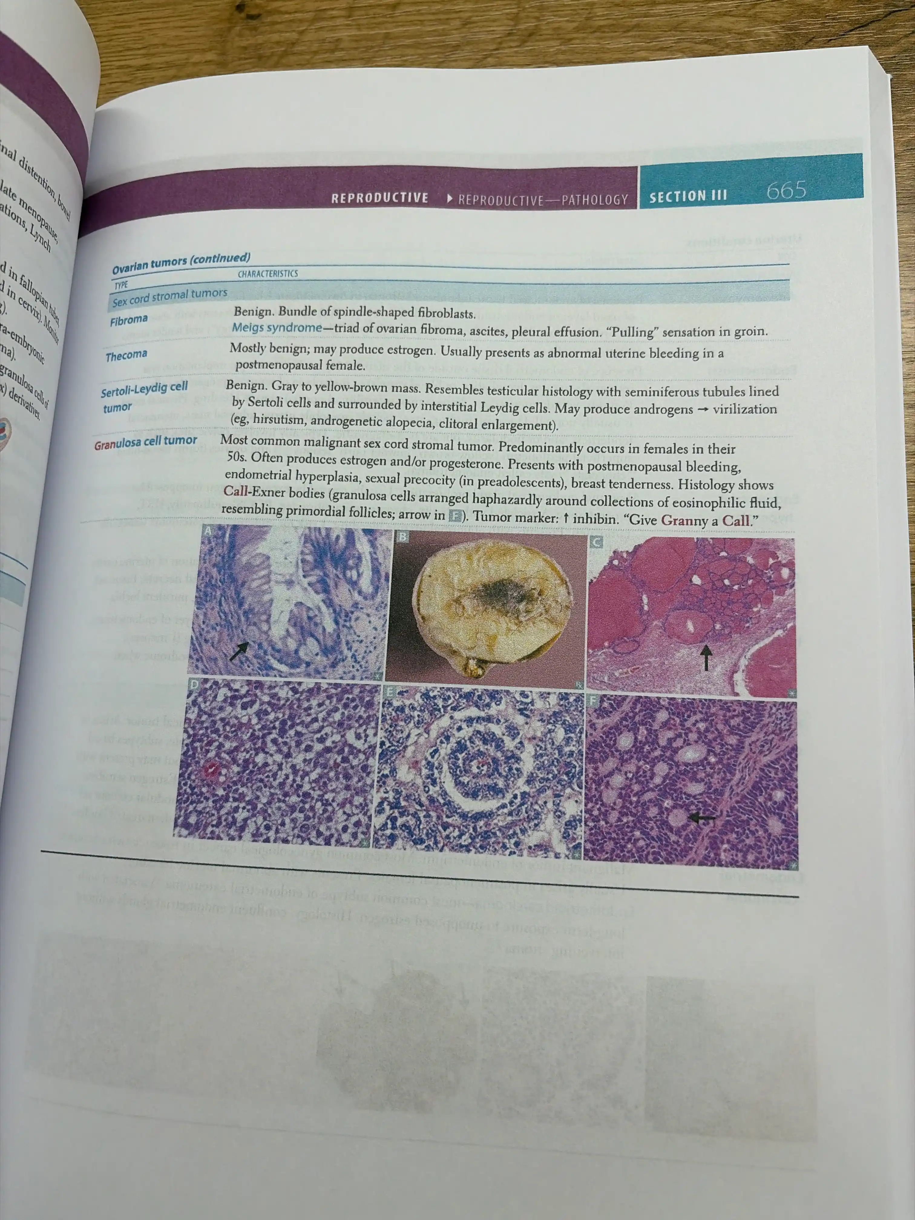 Tibbiyot kitobi, Usmle uchun birinchi yordam 1-qadam 2026, A4 formatidagi imtihonga tayyorgarlik