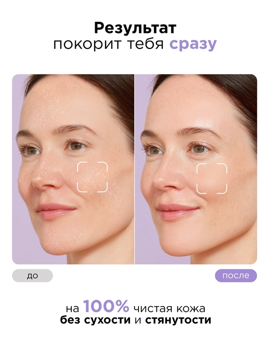 MIXIT Пенка увлажняющая с гиалуроновой кислотой для лица, 150 мл