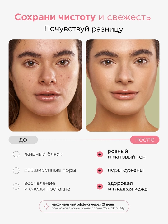 MIXIT Yuz uchun niatsinamid bilan matlovchi tonik 150 ml