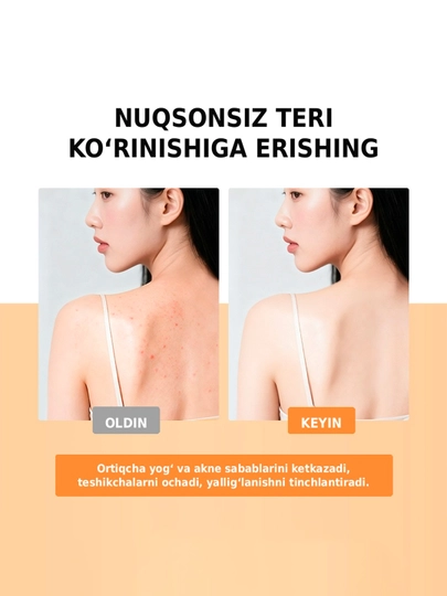 Гель для душа против акне SKINEVER Salicylic Acid Body Wash с салициловой кислотой, 200 мл